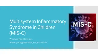 Overview of Multisystem Inflammatory Syndrome in Children