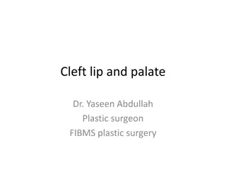 Cleft Lip and Palate Abnormalities