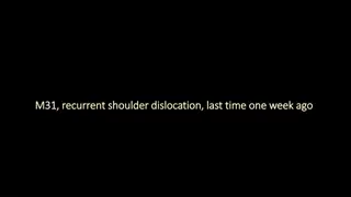 Recurrent Shoulder Dislocation: Last Week's Episode