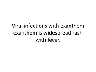 Measles: Symptoms, Complications, and Management