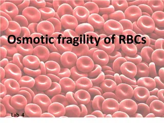 Osmotic Fragility Test in Hematology