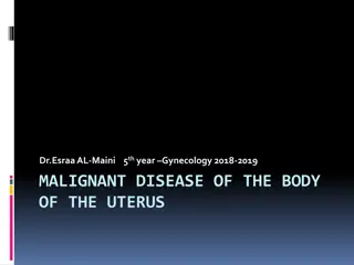 Malignant Disease of the Uterus: Endometrial Cancer Overview