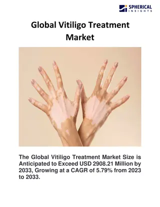 Global Vitiligo Treatment Market