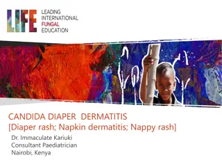 Candida Diaper Dermatitis in Infancy