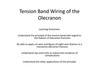 Tension Band Wiring for Olecranon Fractures