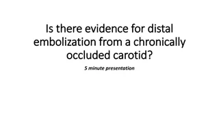 Evidence for Distal Embolization from Chronic Carotid Occlusion