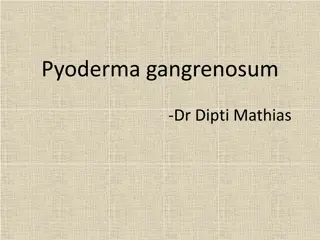 Diagnosis and Treatment of Pyoderma Gangrenosum