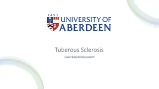 Tuberous Sclerosis Case Based Discussion