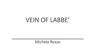 Vein of Labbe: Vital Brain Venous Channel