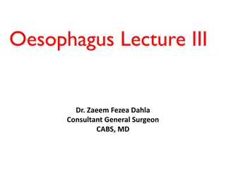 Barrett's Esophagus: Metaplastic Change in Esophagus Lining