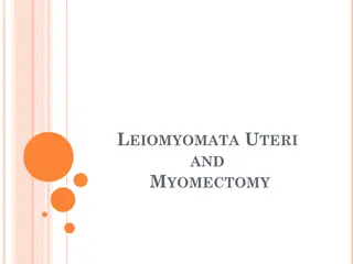 Uterine Leiomyomata: Etiology, Pathology, and Growth