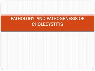 Pathology and Pathogenesis of Cholecystitis: Recognizing Predisposing Factors