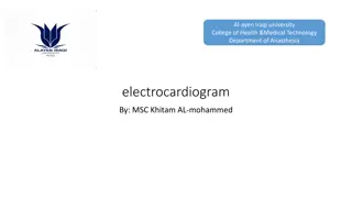 Electrocardiogram Waves