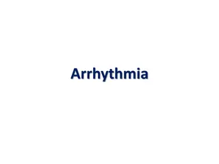 Arrhythmia