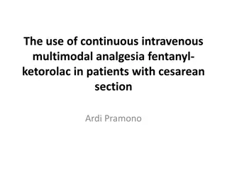 Continuous Intravenous Multimodal Analgesia in Cesarean Section