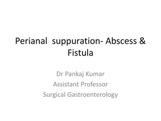 Perianal Suppuration: Abscess & Fistula