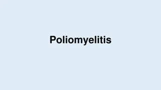 Poliomyelitis: Viral Infection and Paralysis