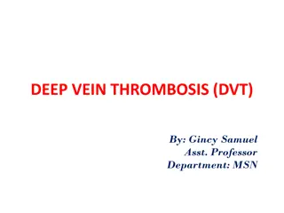 Deep Vein Thrombosis (DVT) - Causes, Symptoms, and Treatment