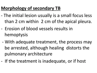 Morphology of Secondary Tuberculosis and Its Clinical Features