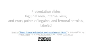 Internal View and Entry Points of Inguinal and Femoral Hernias