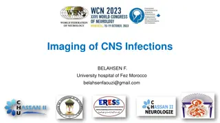Imaging of CNS Infections: Recognizing Pathogens with MRI