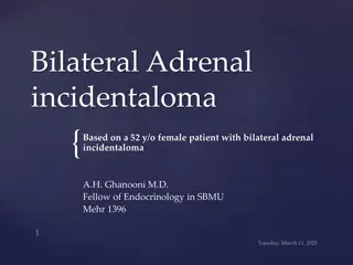 Bilateral Adrenal  incidentaloma