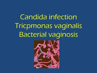 Vaginal Infections and Symptoms Overview