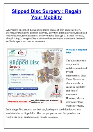 Slipped Disc Surgery - Dr. Shivam Gour