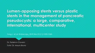 Comparative Study of Lumen-Apposing Stents vs. Plastic Stents in Pancreatic Pseudocysts Management