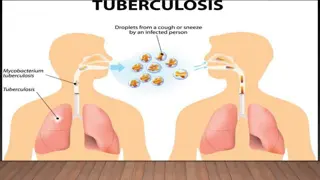 Management and Testing for Tuberculosis