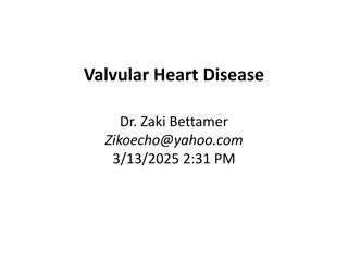 Mitral Stenosis Pathophysiology and Complications