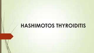 Overview of Hashimoto Thyroiditis: Names, Mechanisms, and More
