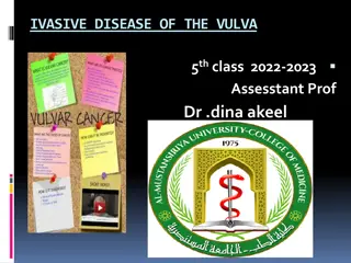 Invasive Disease of the Vulva: Epidemiology & Clinical Features