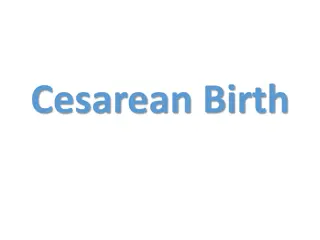 Cesarean Birth