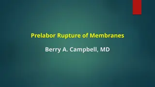Prelabor Rupture of Membranes and PROM