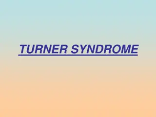Turner Syndrome - Causes, Symptoms, Diagnosis & Treatment