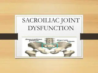Sacroiliac Joint Dysfunction