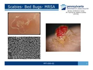 Scabies, Bed Bugs, and MRSA