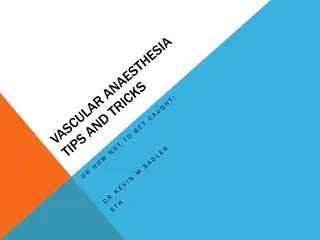 Vascular Operations: A Non-Vascular Anaesthetist's Perspective