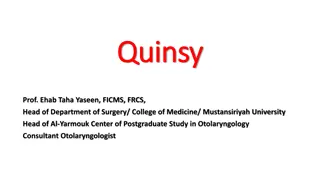 Quinsy (Peritonsillar Abscess) - Causes, Symptoms, and Treatment