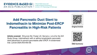 Pancreatic Duct Stent in Minimizing Post-ERCP Pancreatitis