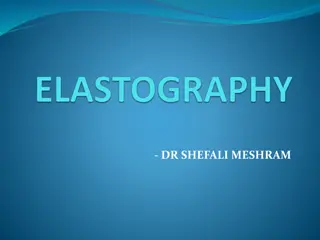 Elastography and Tissue Mechanics