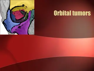 Orbital Tumors and Clinical Evaluation