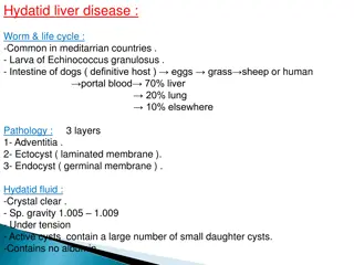 Overview of Hydatid Liver Disease