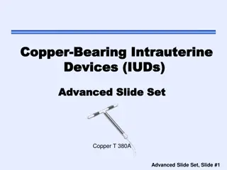 Comprehensive Insights on Copper IUDs and Women's Health