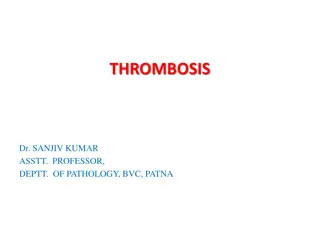 Thrombosis: Causes, Mechanism, and Management