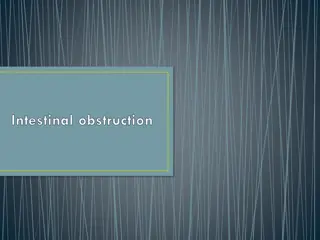 Intestinal obstruction