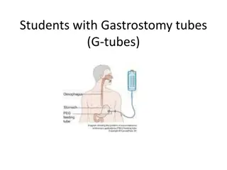 Gastrostomy Tubes in Students