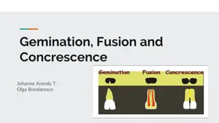 Dental Anomalies: Gemination, Fusion, Concrescence Explained