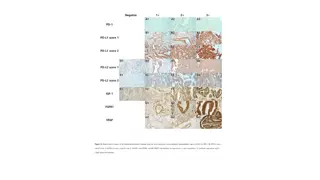 Immunohistochemical Stainings of Periampullary Cancers